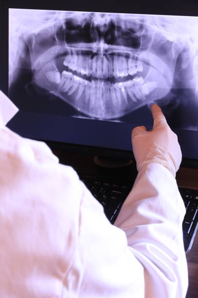 Best Emergency Root Canal Therapy in Junction City, KY