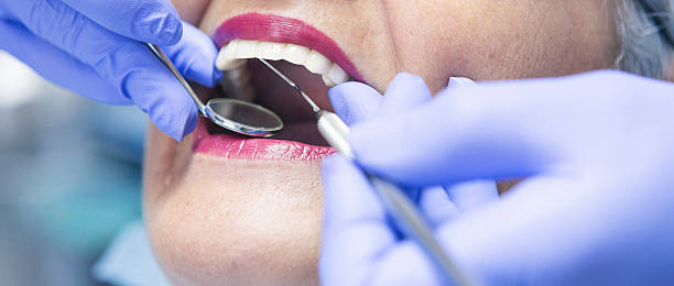 Best Emergency Treatment for Oral Infections in Junction City, KY